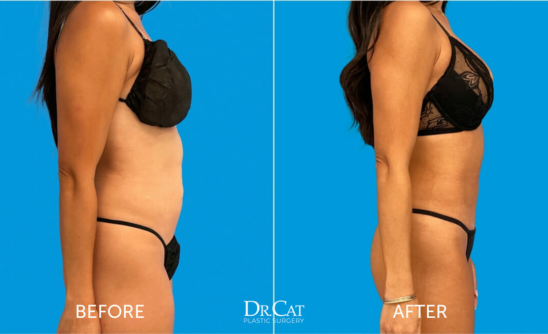 flat stomach Exercises To Get a Flat Stomach