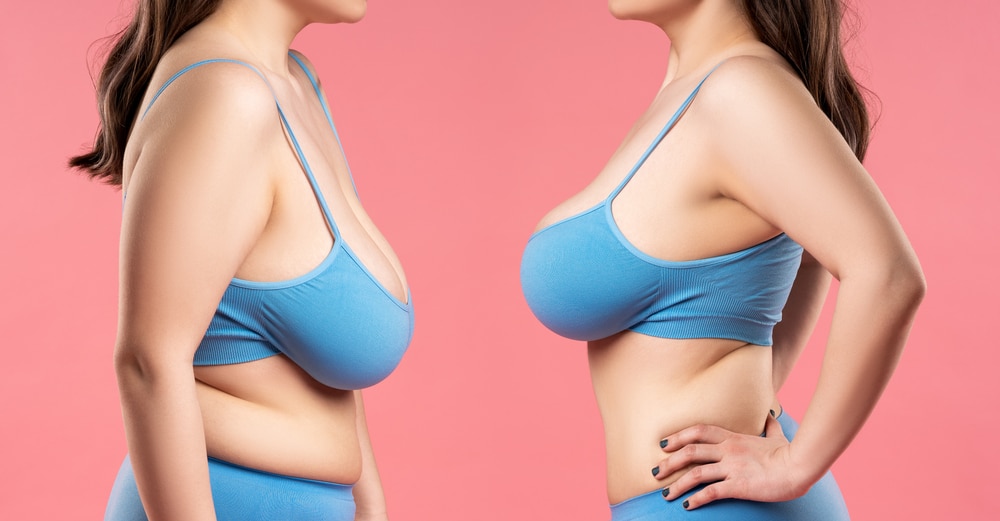 saggy breasts Easy Way To Boost The Shape Of The Breasts: